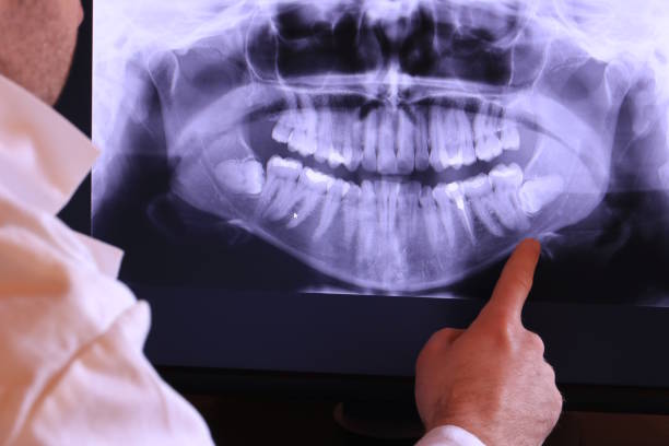 Best Emergency Dentist for Special Needs Patients in Mcchord Af, WA