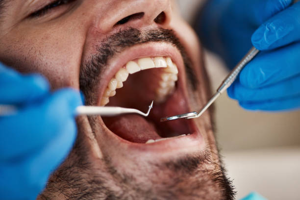 Best Orthodontic Emergency Dentist in Mcchord Af, WA